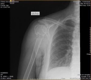 aa_radiografia