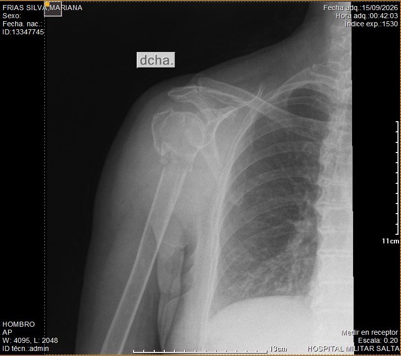aa_radiografia