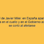 La salud de Javier Milei: en España apareció con una venda en el cuello y en el Gobierno aducen que se cortó al afeitarse
